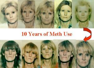 10 years of meth use
